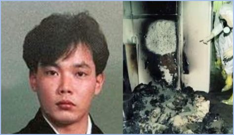 The Devastating Aftermath: Hisashi Ouchi's Autopsy Reveals Extent Of Radiation Damage